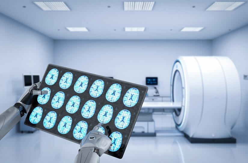 Yapay Zeka Alzheimer Yapay Zeka Alzheimer